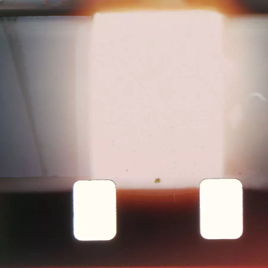 Skin Type Image